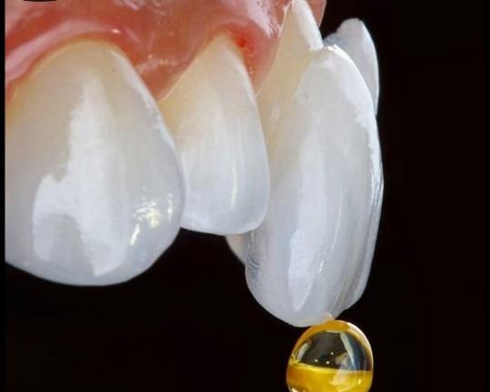 DENTAL VENNERS (1)